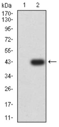 KA2/GRIK5/Glutamate Receptor KA2 Antibody (4G5H8) - BSA Free, Novus Biologicals:Antibodies:Primary